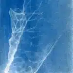 track-artwork